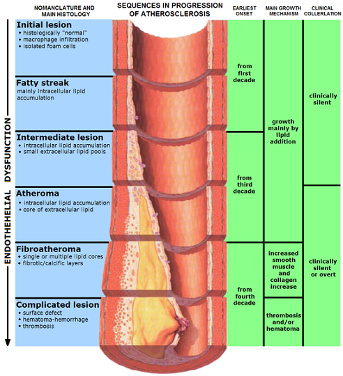 Image of endotheheltal dysfunction atherosclerosis