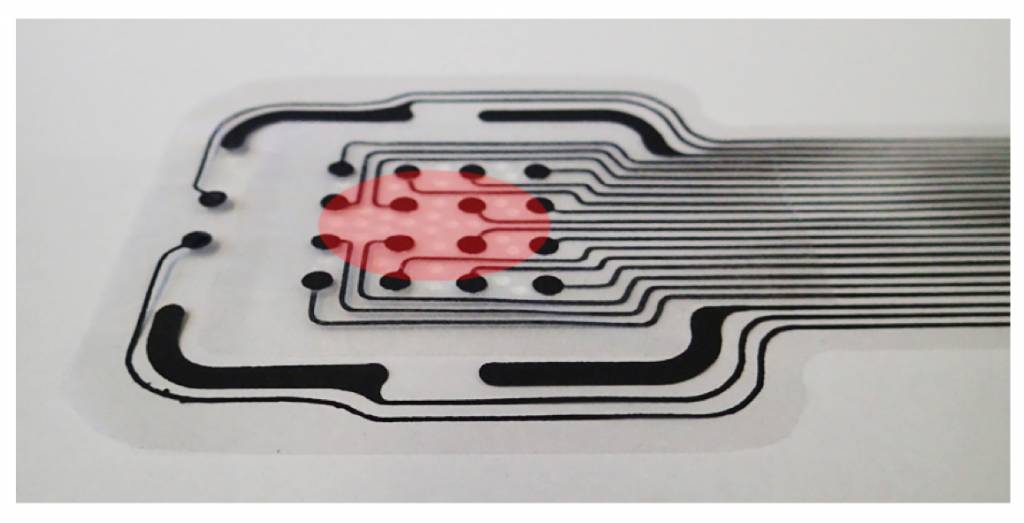 Wound monitoring by bioimpedance measurement