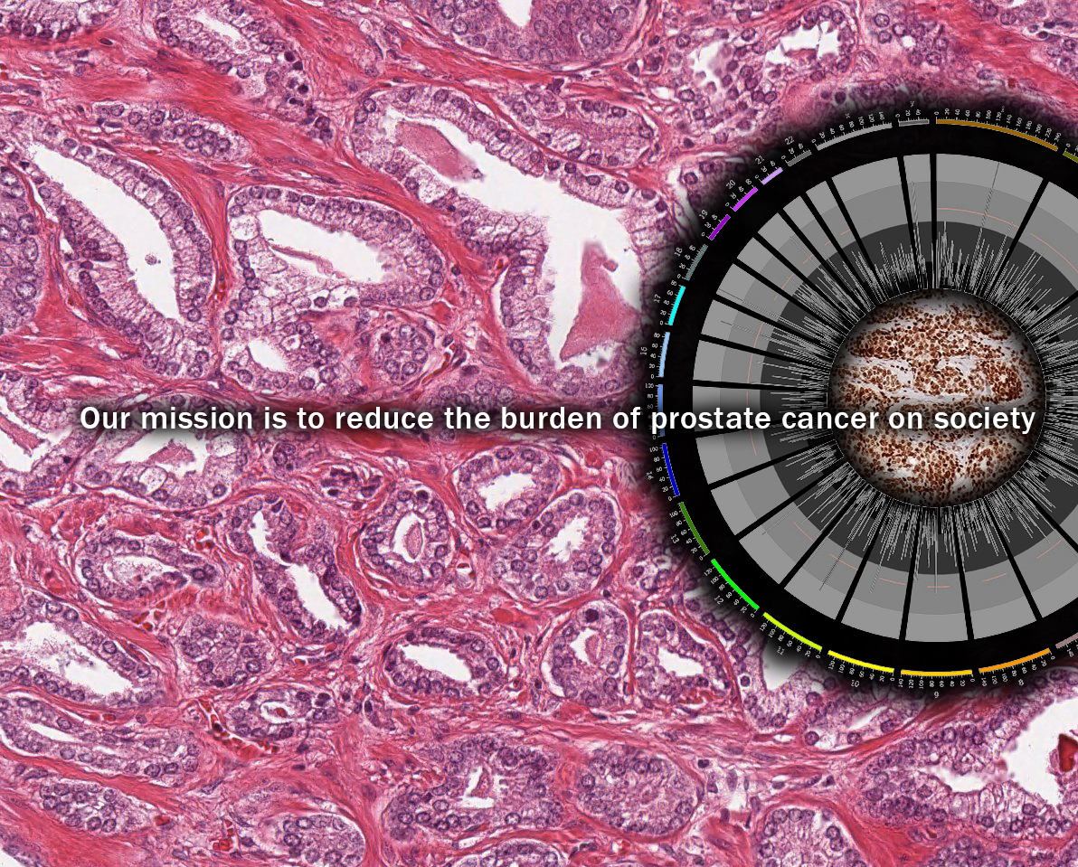 Our mission is to reduce the burden of the prostate cancer on society