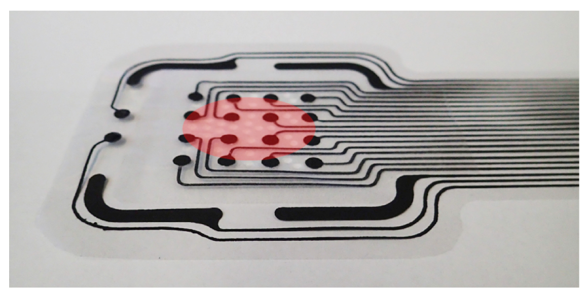 Wound monitoring by bioimpedance measurement
