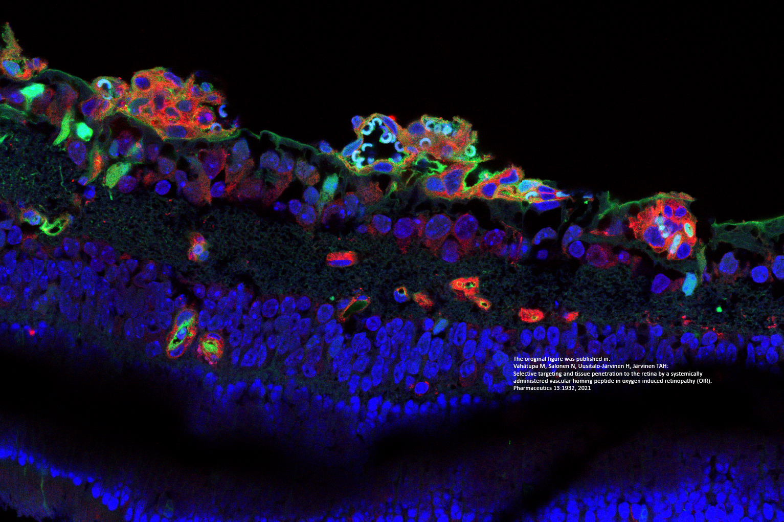 The oroginal figure was published in: Vähätupa M, Salonen N, Uusitalo-Järvinen H, Järvinen TAH: Selective targeting and tissue penetration to the retina by a systemically administered vascular homing peptide in oxygen induced retinopathy (OIR). Pharmaceutics 13:1932, 2021