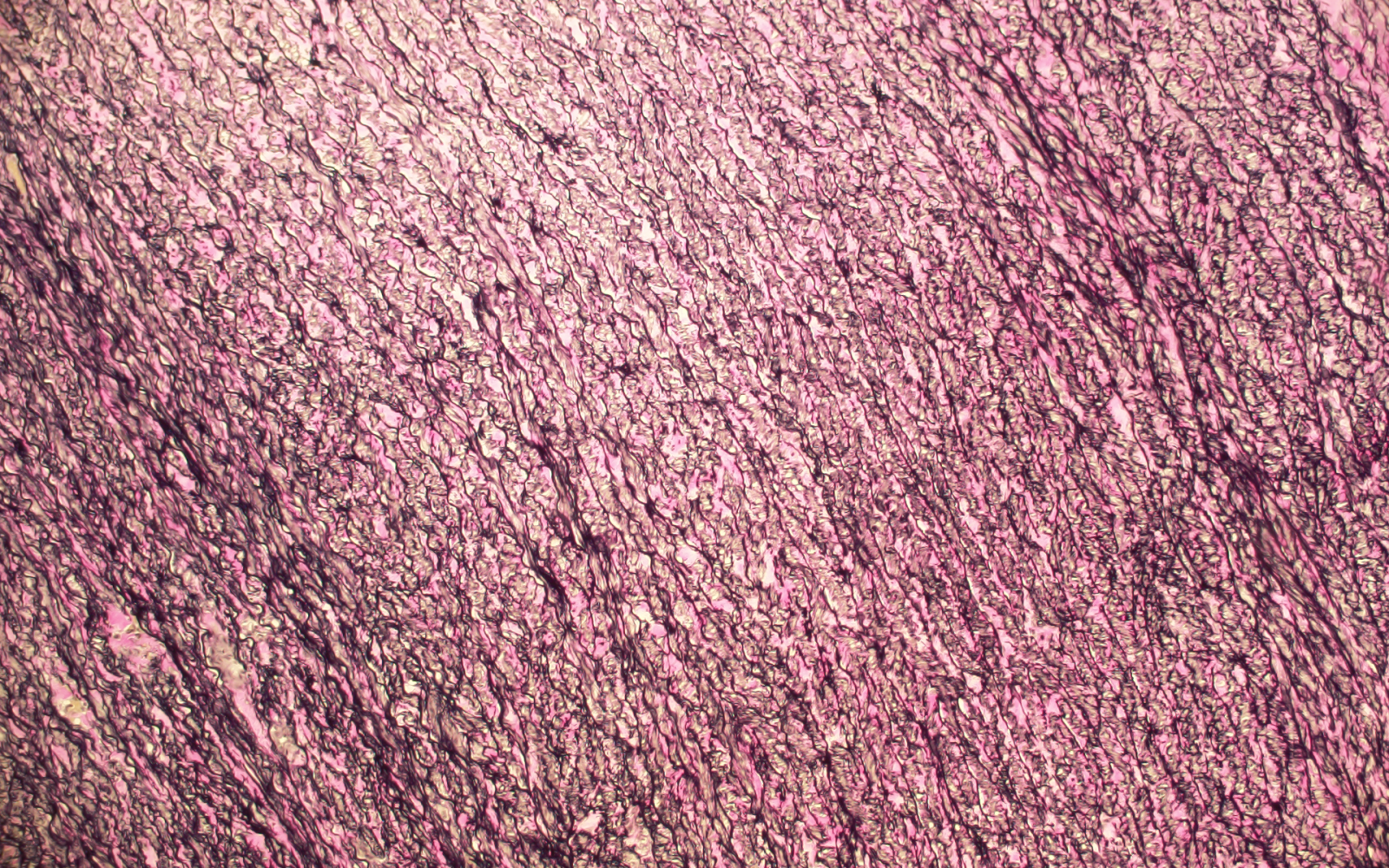 pink microscope picture