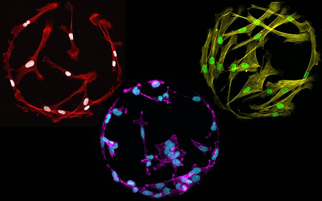 ECM spots